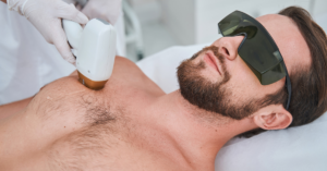 man getting chest hair removed with laser hair removal treatment